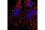 Immunofluorescent staining of human cell line U-2 OS shows localization to focal adhesion sites.
