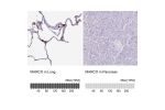 Immunohistochemistry analysis in human lung and pancreas tissues using HPA063793 antibody. Corresponding MARCO RNA-seq data are presented for the same tissues.