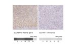 Immunohistochemistry analysis in human adrenal gland and pancreas tissues using HPA063797 antibody. Corresponding SLC18A1 RNA-seq data are presented for the same tissues.