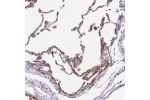 Immunohistochemical staining of human lung shows moderate cytoplasmic positivity in pneumocytes.
