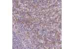 Immunohistochemical staining of human spleen shows strong membranous positivity in cells in red pulp.