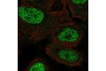 Immunofluorescent staining of human cell line U-2 OS shows localization to nucleoplasm.