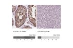 Immunohistochemistry analysis in human testis and liver tissues using Anti-ATG16L1 antibody. Corresponding ATG16L1 RNA-seq data are presented for the same tissues.