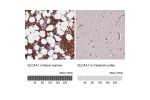 Immunohistochemistry analysis in human bone marrow and cerebral cortex tissues using Anti-SLC4A1 antibody. Corresponding SLC4A1 RNA-seq data are presented for the same tissues.