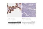 Immunohistochemistry analysis in human prostate and endometrium tissues using Anti-ACPP antibody. Corresponding ACPP RNA-seq data are presented for the same tissues.