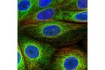 Immunofluorescent staining of human cell line MCF7 shows localization to endoplasmic reticulum.