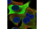 Immunofluorescent staining of human cell line SK-MEL-30 shows localization to plasma membrane.