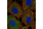 Immunofluorescent staining of human cell line A549 shows localization to cytosol.