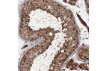 Immunohistochemical staining of human testis shows strong nuclear and cytoplasmic positivity in cells in seminiferous ducts and Leydig cells.