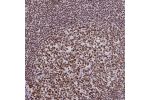 Immunohistochemistry analysis in human ovary and liver tissues using Anti-TRIM28 antibody. Corresponding TRIM28 RNA-seq data are presented for the same tissues.