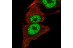 Immunofluorescent staining of human cell line SK-MEL-30 shows localization to nucleoplasm.