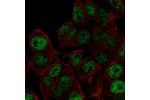 Immunofluorescent staining of human cell line Hep G2 shows localization to nucleoplasm.