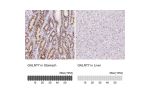 Immunohistochemistry analysis in human stomach and liver tissues using HPA064243 antibody. Corresponding GALNT7 RNA-seq data are presented for the same tissues.