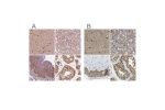 Immunohistochemical staining of human cerebral cortex, kidney, skin and testis using Anti-PSMC5 antibody HPA064293 (A) shows similar protein distribution across tissues to independent antibody HPA017871 (B).