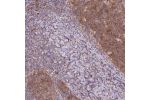 Immunohistochemical staining of human tonsil shows cytoplasmic positivity in germinal center.