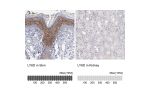 Immunohistochemistry analysis in human skin and kidney tissues using HPA064317 antibody. Corresponding LY6D RNA-seq data are presented for the same tissues.