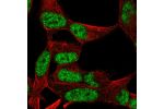 Immunofluorescent staining of human cell line SH-SY5Y shows localization to nucleoplasm.