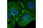 Immunofluorescent staining of human cell line HaCaT shows localization to plasma membrane.