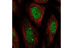 Immunofluorescent staining of human cell line SiHa shows localization to nucleoplasm.