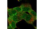 Immunofluorescent staining of human cell line SH-SY5Y shows localization to nucleoplasm, cytosol & vesicles.