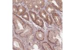 Immunohistochemical staining of human stomach shows cytoplasmic and nuclear positivity in glandular cells.