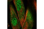 Immunofluorescent staining of human cell line BJ shows localization to nucleoplasm & cytosol.