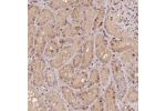 Immunohistochemical staining of human kidney shows moderate cytoplasmic and nuclear positivity in cells in tubules.