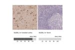 Immunohistochemistry analysis in human cerebral cortex and tonsil tissues using Anti-SEZ6L2 antibody. Corresponding SEZ6L2 RNA-seq data are presented for the same tissues.
