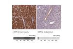 Immunohistochemistry analysis in human heart muscle and lymph node tissues using Anti-GOT1 antibody. Corresponding GOT1 RNA-seq data are presented for the same tissues.