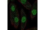 Immunofluorescent staining of human cell line RPTEC TERT1 shows localization to nucleoplasm.