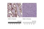 Immunohistochemistry analysis in human placenta and pancreas tissues using Anti-RASA1 antibody. Corresponding RASA1 RNA-seq data are presented for the same tissues.