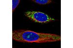 Immunofluorescent staining of human cell line SiHa shows localization to nucleoli & mitochondria.