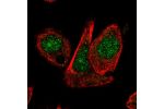 Immunofluorescent staining of human cell line PC-3 shows localization to nucleus & nucleoli.