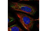 Immunofluorescent staining of human cell line SiHa shows localization to the Golgi apparatus & vesicles.