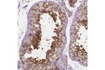 Immunohistochemical staining of human testis shows moderate cytoplasmic positivity in cells in seminiferous ducts.