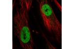 Immunofluorescent staining of human cell line BJ shows localization to nucleoplasm.