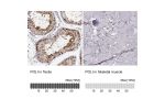 Immunohistochemistry analysis in human testis and skeletal muscle tissues using Anti-POLI antibody. Corresponding POLI RNA-seq data are presented for the same tissues.