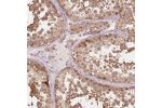 Immunohistochemical staining of human testis shows moderate cytoplasmic and nuclear positivity in cells in seminiferous ducts and Leydig cells.