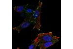 Immunofluorescent staining of human cell line Hep G2 shows localization to focal adhesion sites.