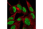 Immunofluorescent staining of human cell line SH-SY5Y shows localization to nucleoplasm.