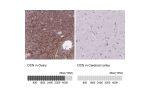 Immunohistochemistry analysis in human ovary and cerebral cortex tissues using Anti-DCN antibody. Corresponding DCN RNA-seq data are presented for the same tissues.