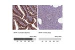 Immunohistochemistry analysis in human small intestine and pancreas tissues using Anti-MVP antibody. Corresponding MVP RNA-seq data are presented for the same tissues.