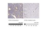 Immunohistochemistry analysis in human endometrium and skeletal muscle tissues using HPA064783 antibody. Corresponding MYH9 RNA-seq data are presented for the same tissues.