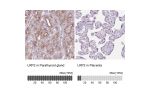 Immunohistochemistry analysis in human parathyroid gland and placenta tissues using HPA064792 antibody. Corresponding LRP2 RNA-seq data are presented for the same tissues.