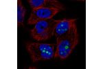 Immunofluorescent staining of human cell line SK-MEL-30 shows localization to nucleoli.