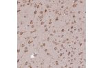 Immunohistochemical staining of human cerebral cortex shows strong cytoplasmic positivity in neuronal cells.