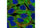Immunofluorescent staining of human cell line RT4 shows localization to cytosol.