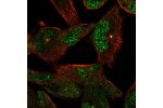 Immunofluorescent staining of human cell line RH-30 shows localization to nucleoplasm & centrosome.