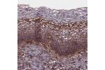 Immunohistochemical staining of human Cervix shows moderate cytoplasmic and membranous positivity in squamous epithelial cells.