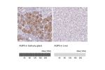 Immunohistochemistry analysis in human salivary gland and liver tissues using HPA065008 antibody. Corresponding AQP5 RNA-seq data are presented for the same tissues.
